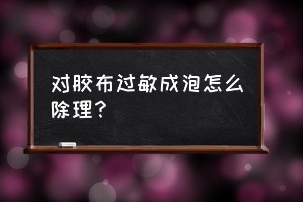 纸胶带过敏怎么办 对胶布过敏成泡怎么除理？